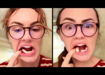 Teeth Aren’t Supposed to Do This