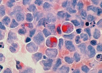 The FDA Should Grant Americans the Right to Try New Cancer Treatments