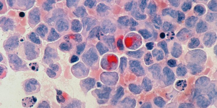 The FDA Should Grant Americans the Right to Try New Cancer Treatments